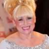 Classy Barbara Windsor Diamond Painting